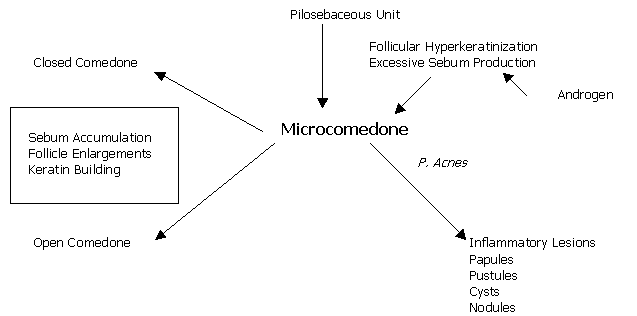 Acne Vulgaris